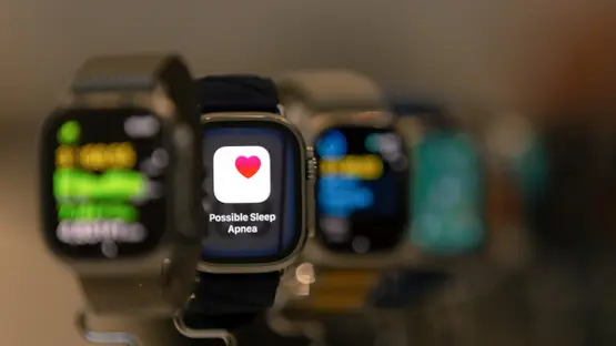 "أبل" تختبر ميزة جديدة لمراقبة نبضات القلب على مدار اليوم في Apple Watch