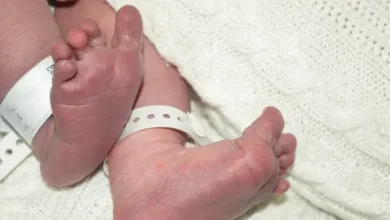 في عمر يوم واحد.. جراحة قلب مفتوح تنقذ مولوداً في مصر