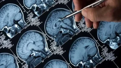 العلاج بالرنين المغناطيسي المتكرر... حل فعّال لمواجهة الاكتئاب