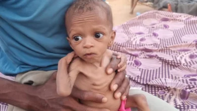 من تهاني إلى جياد.. قصص أطفال اليمن مع الجوع والمساعدات المتأخرة