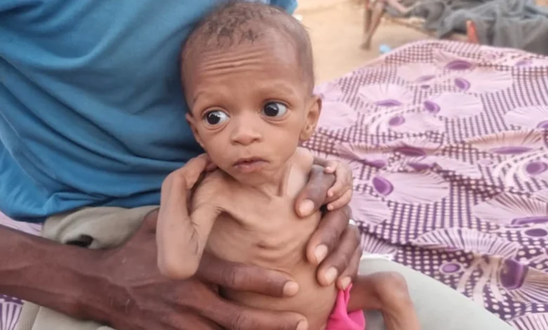 من تهاني إلى جياد.. قصص أطفال اليمن مع الجوع والمساعدات المتأخرة