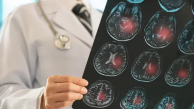 ضعف الذاكرة بعد الستين.. علامة مبكرة قد تكشف خطر السكتة الدماغية