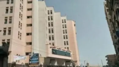 جراحة نادرة ..استخراج جنين من معدة رضيعة مصرية