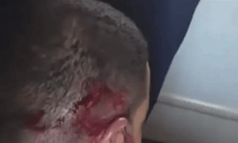 تأثر بأفكار مُتطرفة.. نشر أول صورة لمساعد الطيار في "فلاي دبي" بعد السيطرة عليه